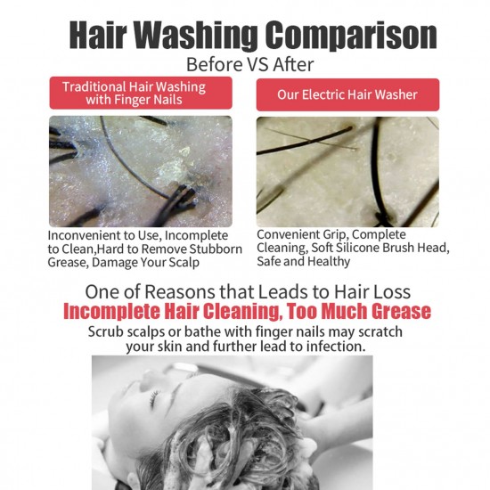 Hair Scalp Massager Shampoo Brush, Soft Silicone Scalp Care Brush Wet and Dry Hair Scalp Brush Acoustic Wave Massage Hair Washer with Three Replaceable Brush Heads for Men, Women, Kids and Pets Hair Scalp Massager Shampoo Brush, Soft Silicone Scalp Care Brush Wet and Dry Hair Scalp Brush Acoustic Wave Massage Hair Washer with Three Replaceable Brush Heads for Men, Women, Kids and Pets
